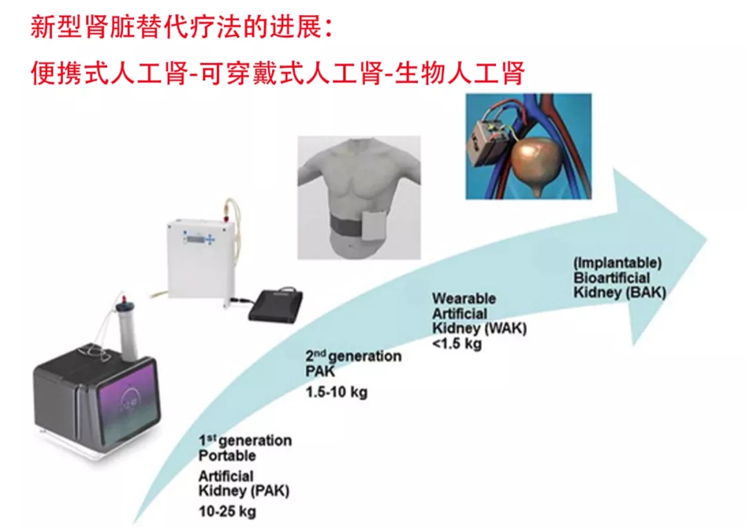 人工肾脏最新研究成果，突破前沿科技，创新医疗技术引领未来