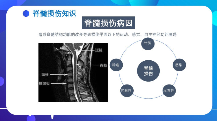 脊髓损伤最新研究进展综述与治疗方法探讨